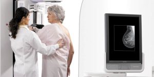 3d-mammogram
